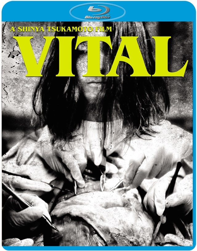 Vital - 1