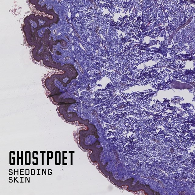 Shedding Skin - 1