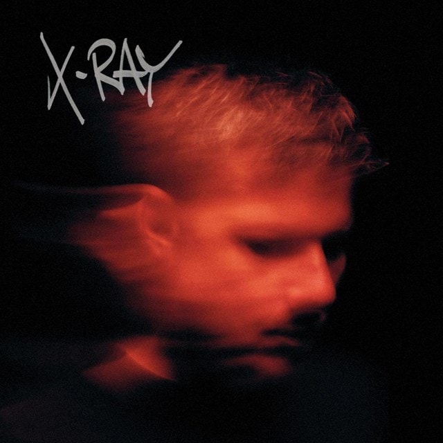 X-Ray - 1