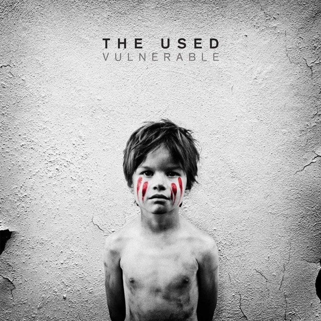 Vulnerable - 1