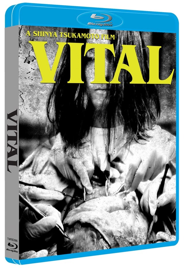 Vital - 2